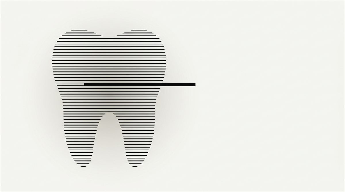 Abstract illustration: a tooth drawn from fine horizontal lines, with a single line marked in solid black.